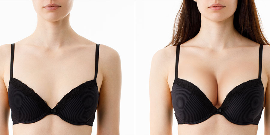 Breast Augementation Surgery in Thimpu