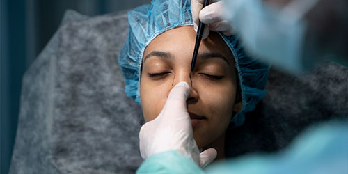 Closed rhinoplasty
