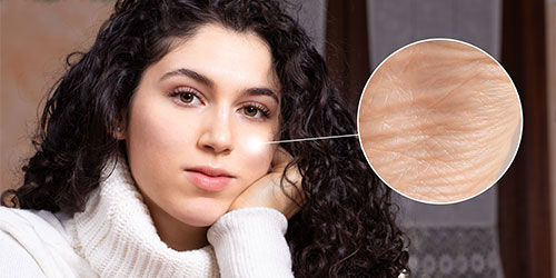 Heavy skin hooding
