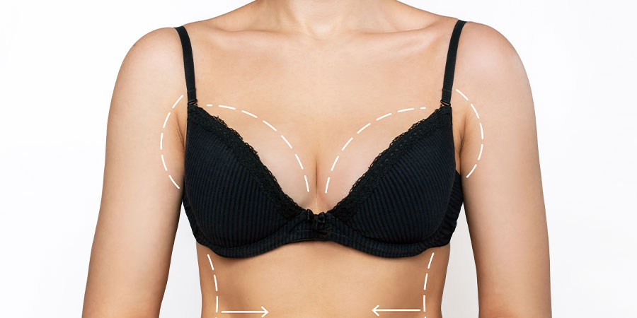 ideal for breast augmentation