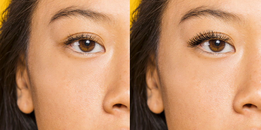 Step-By-Step Rhinoplasty Procedures
