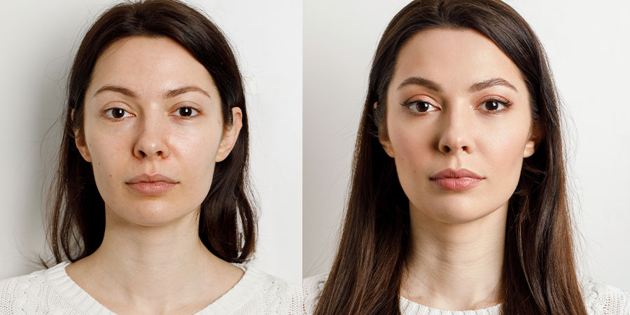 Step-By-Step Facelift Procedures