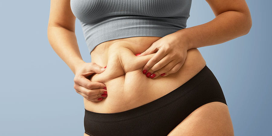 Tummy Tuck vs Liposuction