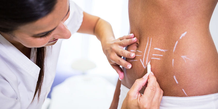 Body Contouring