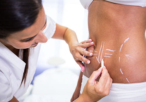Body Contouring