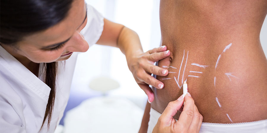 Cryolipolysis